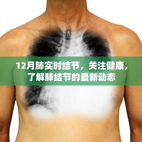 關(guān)注健康，12月肺實時結(jié)節(jié)最新動態(tài)解讀