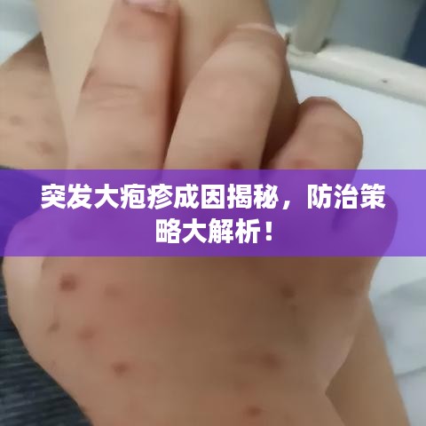 突發(fā)大皰疹成因揭秘，防治策略大解析！