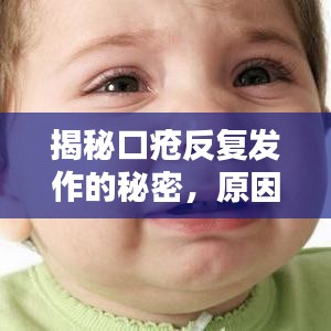 揭秘口瘡反復(fù)發(fā)作的秘密，原因何在？