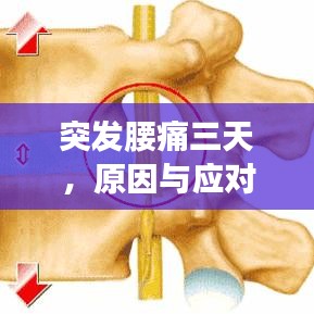 突發(fā)腰痛三天，原因與應(yīng)對(duì)方法探討